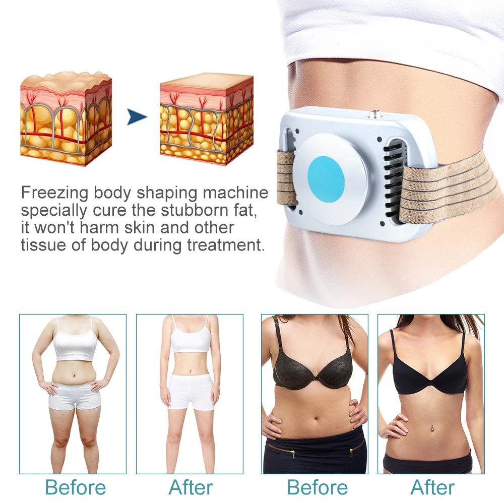 Cryolipolysis Machine Fat Freezing Belly Fat Burner For Women Lipo Lab Fat Disso Review 2026: 202 Verified Reviews